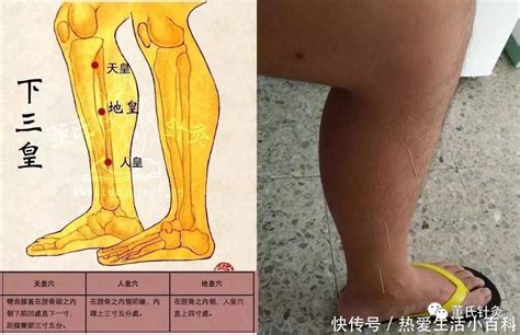 三皇穴位置 剪刀煞化解